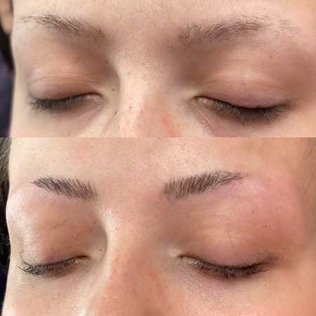 Before and After Brow Lift Lamination
